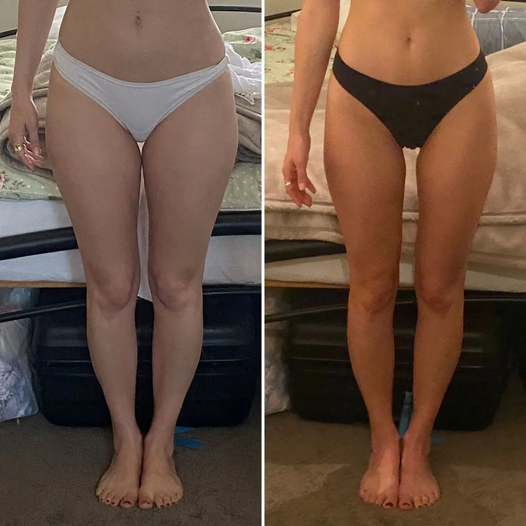 lean legs program before and after transformation